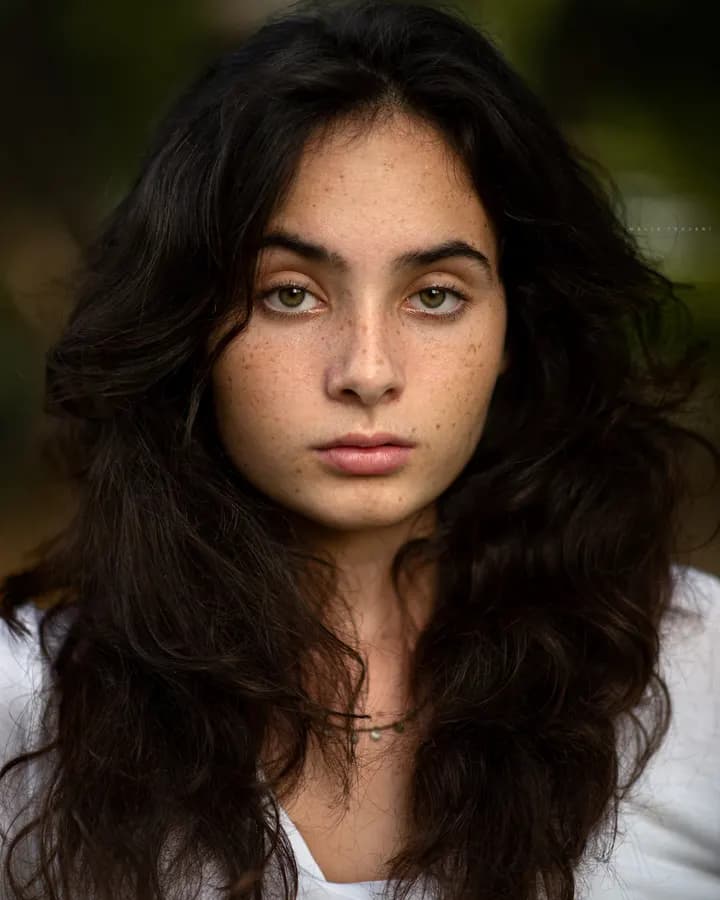 Freckles